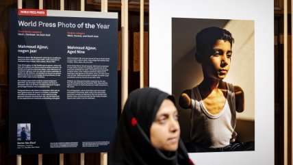   La imagen de prensa de 2024: un niño mutilado por el ejército de Israel 